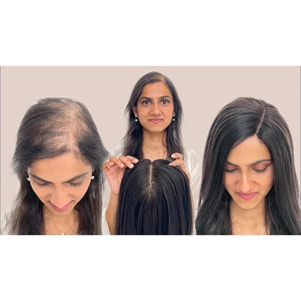 【🔥45%OFF 】100% Natural Human Hair Extensions|Silk Base Hair Topper